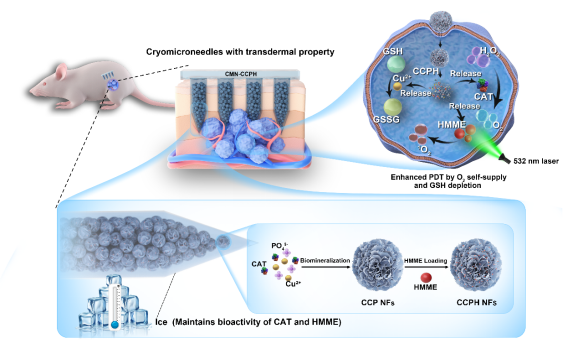 医学部黄鹏教授团队发表新型冰微针贴片用于可视化光动力疗法的研究成果